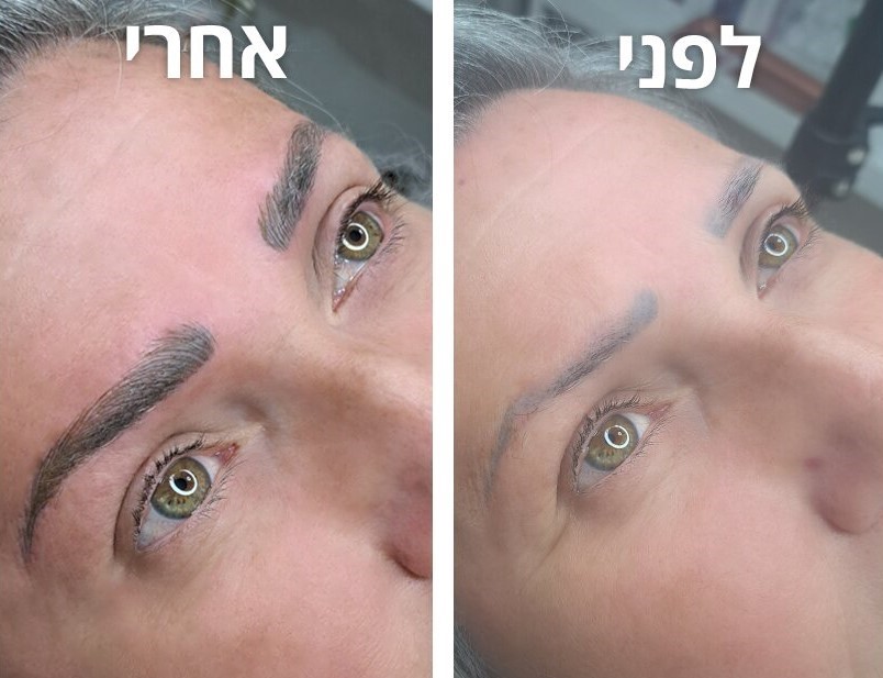 מיקרובליידינג גבות - לפני ואחרי